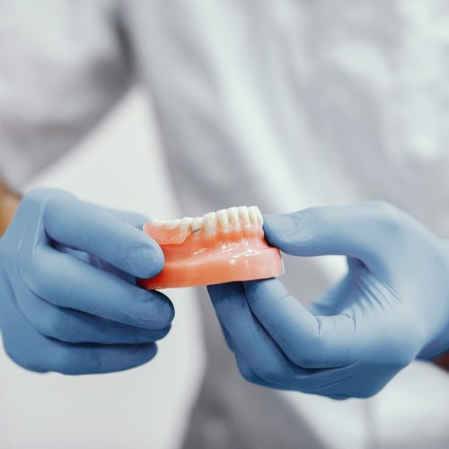 Plastic jaw in the dentist's office. The doctor holds in the hands of dental implants.