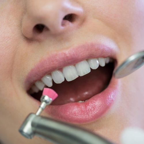 Dentist examining a female patient with tools at dental clinic